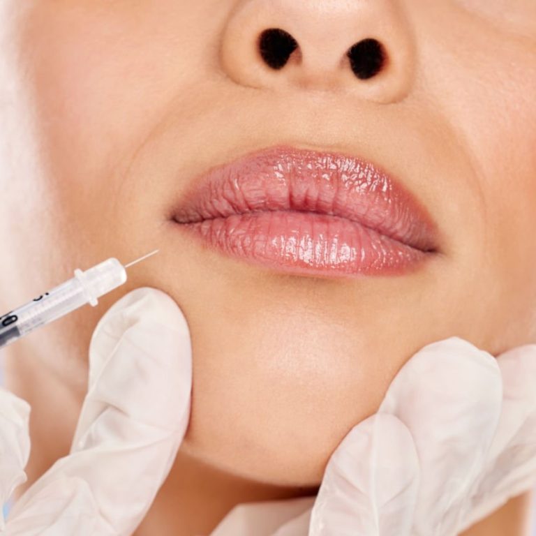 Plump lips, here I come.